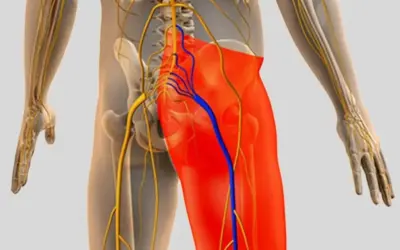 Can Sciatica Cause Hip Pain? Signs and Treatments